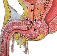 360°全面解析：尿道炎