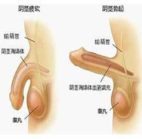 360°全面解析：阳痿